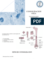 Consolidacion Osea
