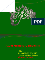Pulmonary Embolism 2013