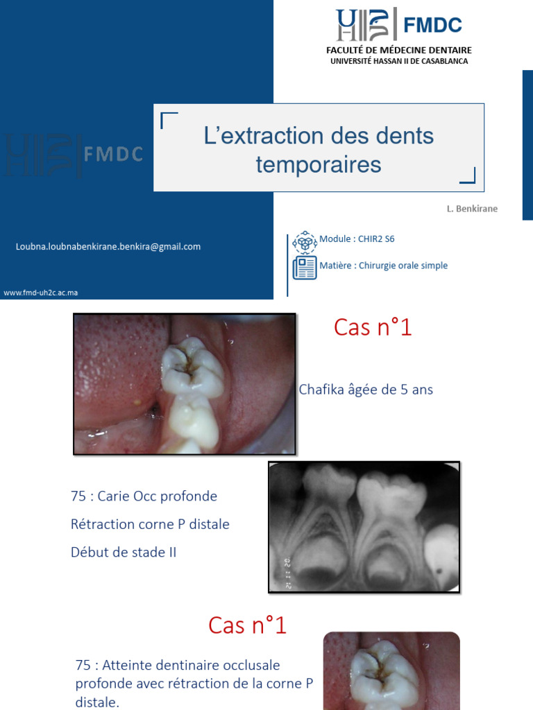 Dépôt blanc après extraction dentaire PDF Dent Infection — free download