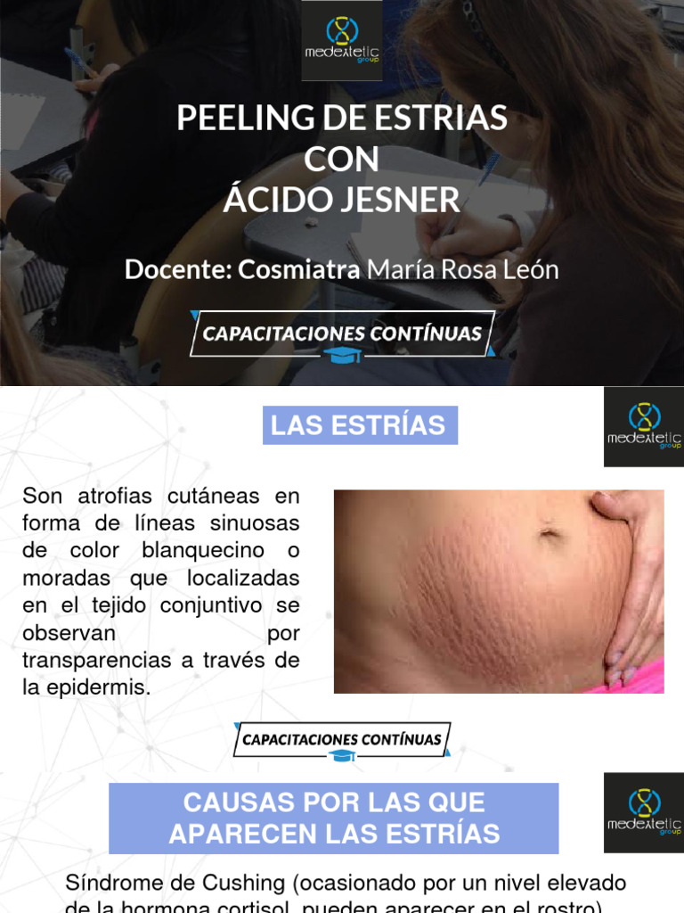 Peeling de Estrías Con Ácido Jesner | PDF | Especialidades Medicas ...