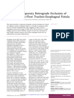 Temporary Retrograde Occlusion of High-Flow Tracheo-Esophageal Fistula