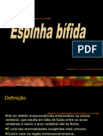 Espinha Bifida 2