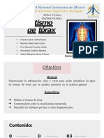 Trauma de Torax