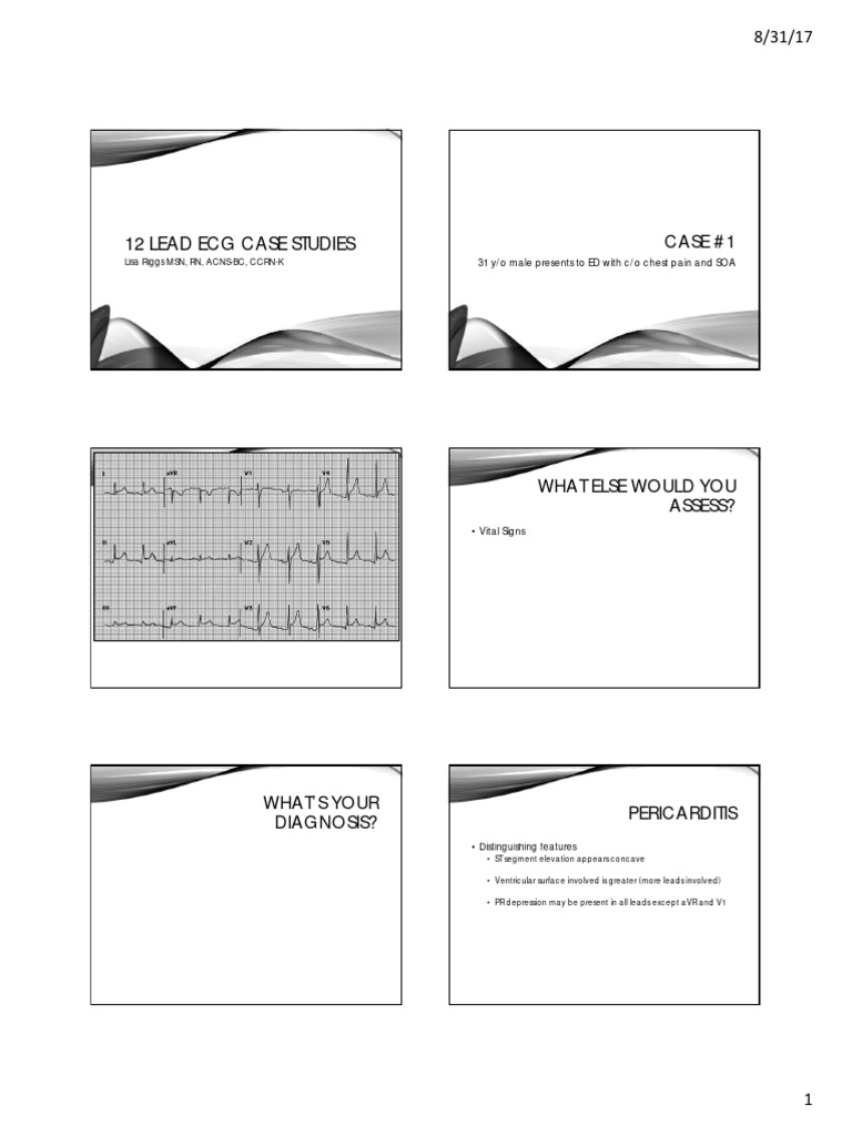 12 Lead ECG Case Studies | PDF | Electrocardiography | Cardiac ...