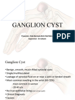 Ganglion Cyst - CME Ortho