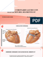 Sindome coronario-2