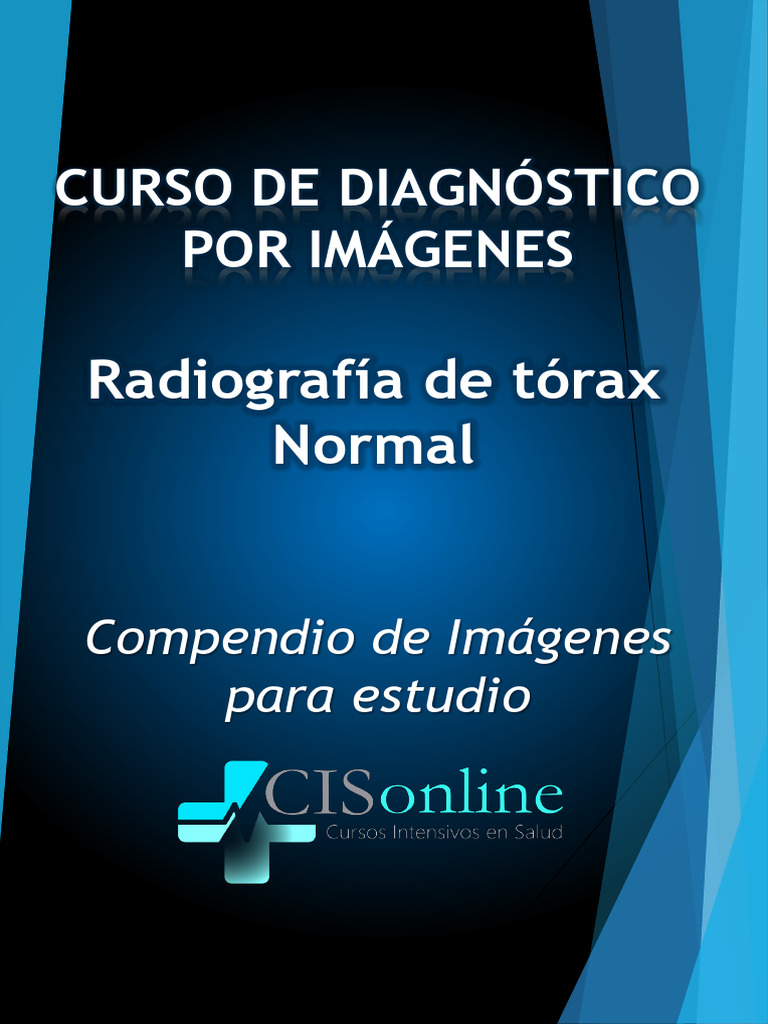 Compendio RX Torax Normal Clase 5 | PDF | Aorta | Pulmón