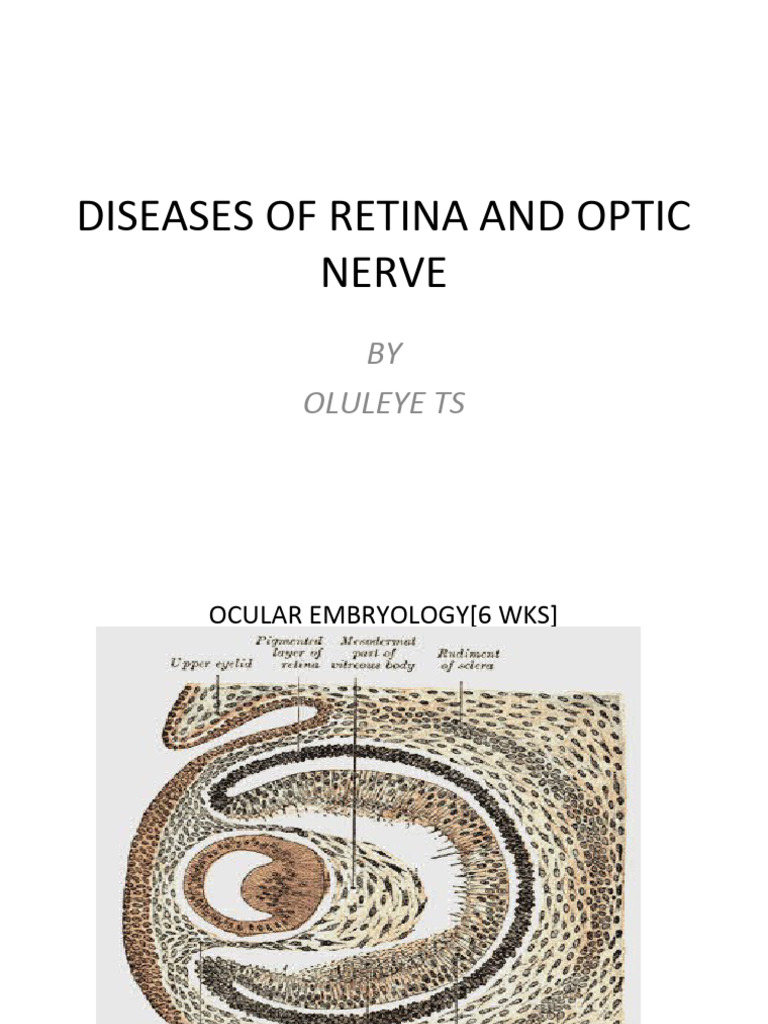 Retina and Optic Nerve Diseases Guide | PDF | Retina | Human Eye