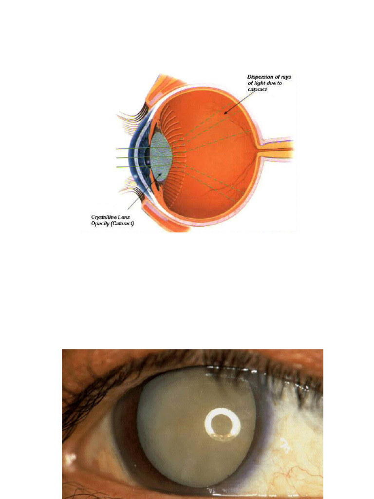 Eye Pictures | PDF