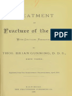 Treatment of Fracture of The Jaw With Critical Remarks - 1 Ed (GUNNING)