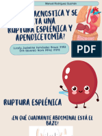 Ruptura esplénica y apendicetomía