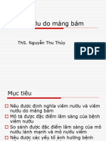 Viêm Nướu Do Mảng Bám