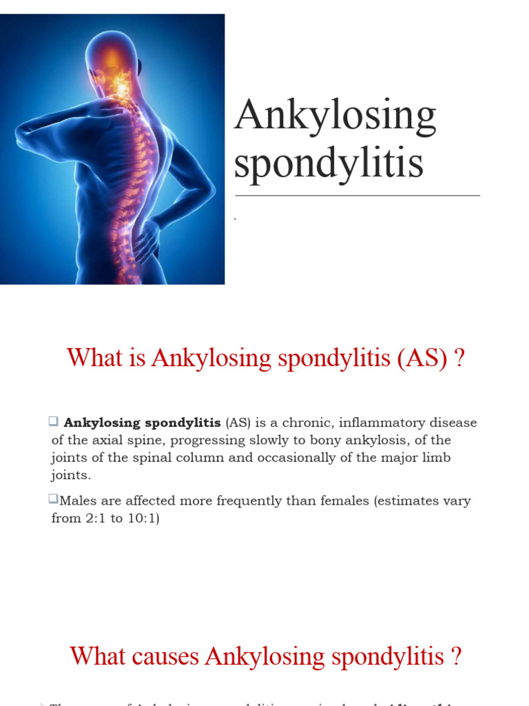 Flesche Test for Ankylosing Spondylitis | PDF | Vertebral Column ...