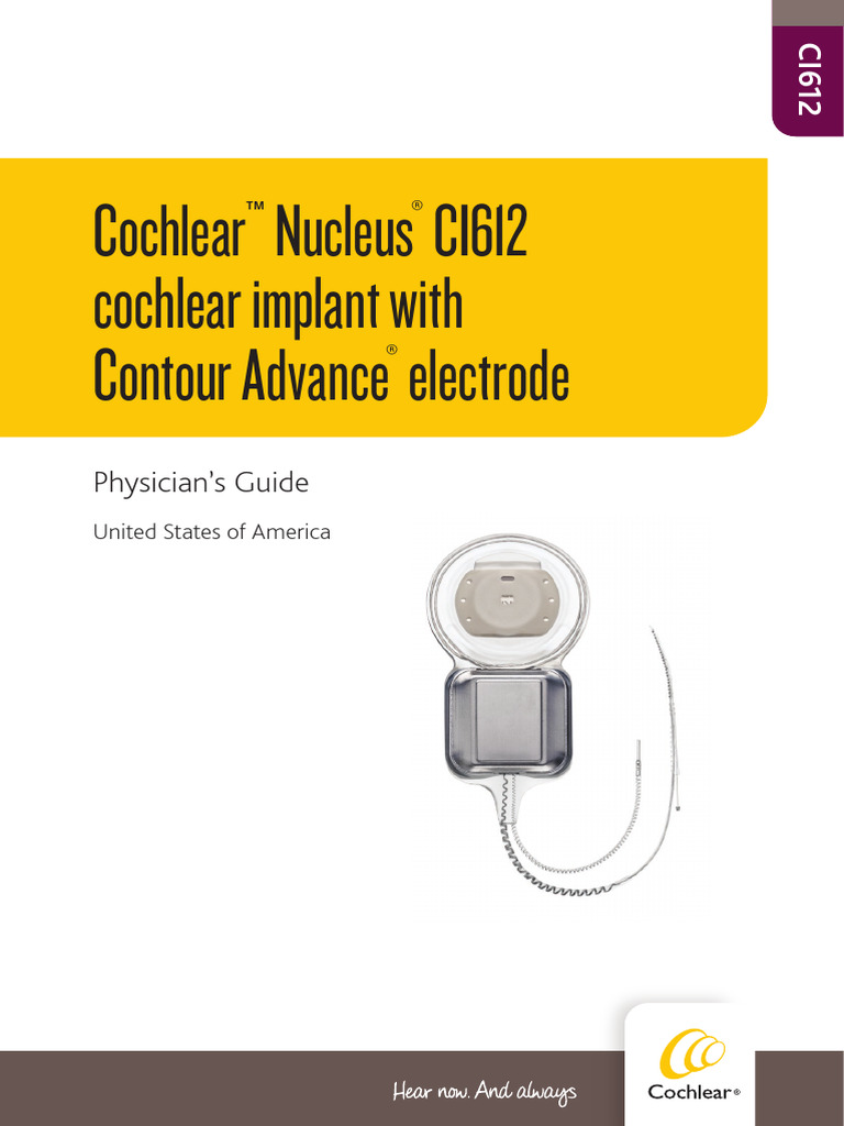Cochlear_implant_2 | PDF | Hearing Loss | Implant (Medicine)