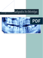 Trabajo de Investigacion Interpretación Radiográfica en Odontología