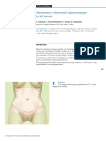 Anastomose Colorectale Laparoscopique à Ciel Ouvert
