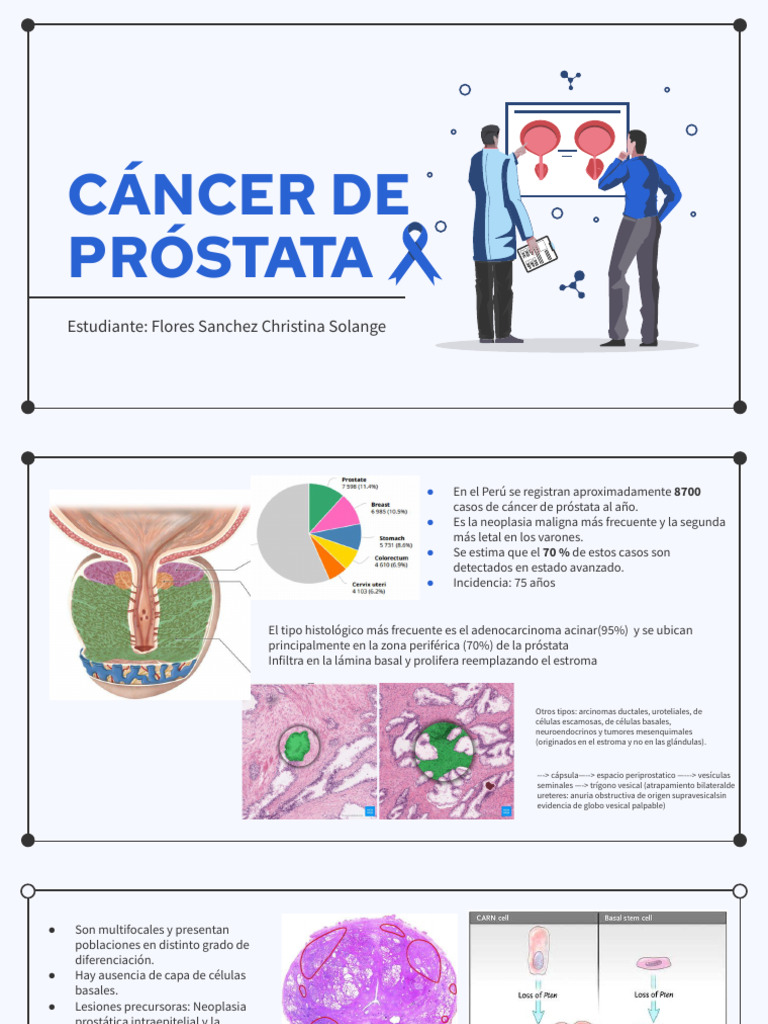 Prostate Cancer | PDF | Antígeno específico de la próstata | Cancer de ...