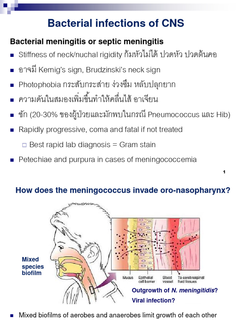 2019 391 Bacterial Infection of CNS | PDF