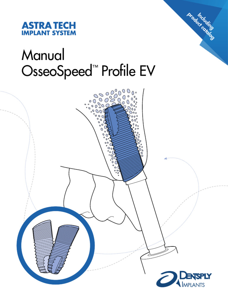 ASTRA TECH Implant System OsseoSpeed Profile Manual 1226924 | PDF ...