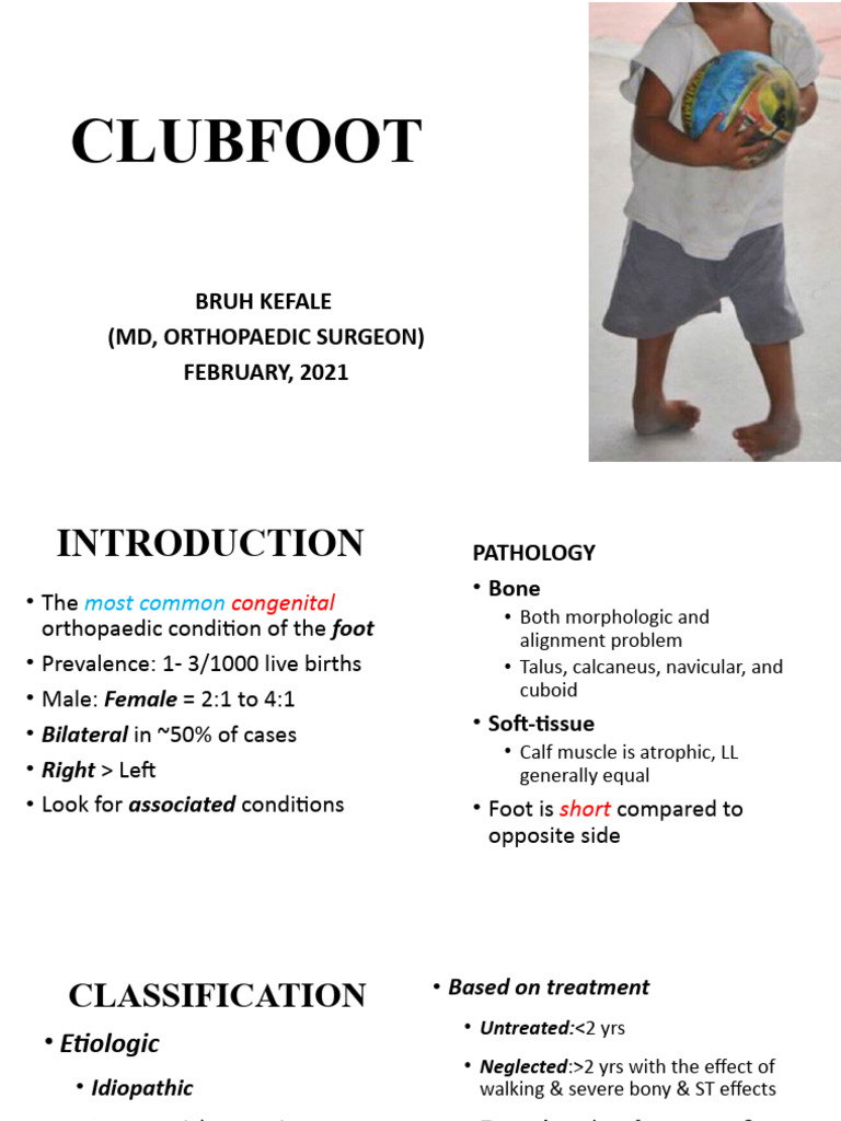 Understanding Clubfoot: Causes and Treatment | PDF | Human Diseases And ...
