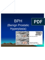 BPH Guide: Symptoms, Causes and Diagnostic Tests