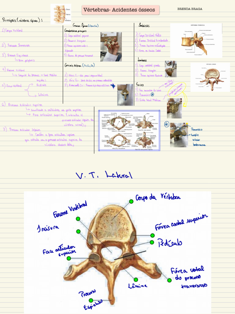 Anatomia e Acidentes Ósseos das Vértebras | PDF | Coluna vertebral ...