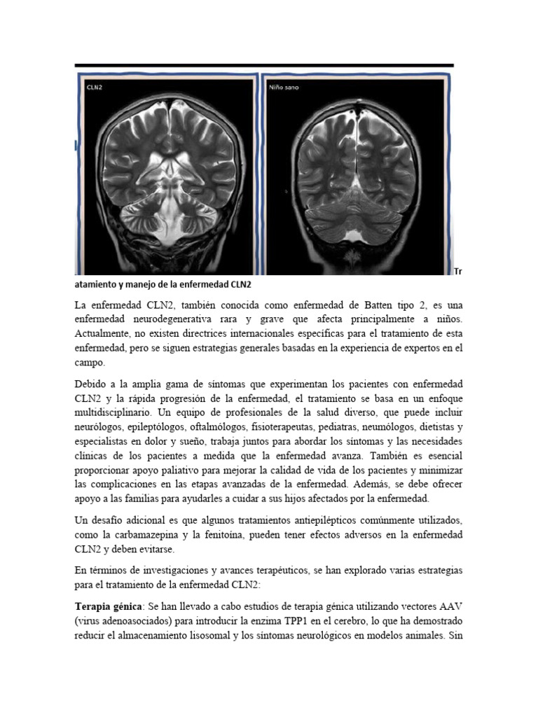 Manejo de la enfermedad CLN2 y terapias | PDF | Terapia | Terapia de genes