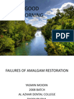 Failures of Amalgam Restoration