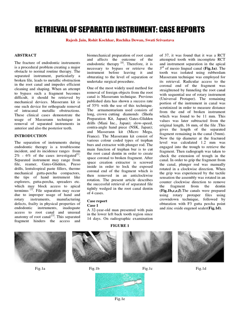 Masserann Technique for Instrument Retrieval | PDF | Dentistry | Mouth
