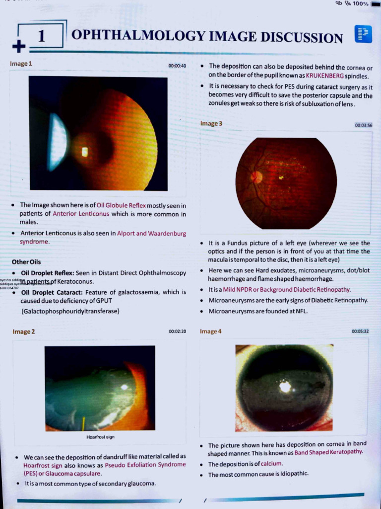 Ophtha RR | PDF | Ophthalmology | Human Eye