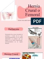 HERNIA CRURAL