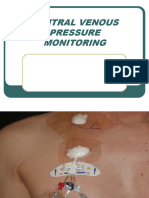 2571central Venous Pressure