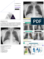 Métodos Diagnosticos Neumologia