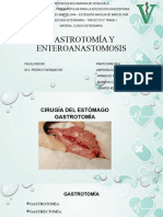 Gastrotomía y Enteroanastomosis