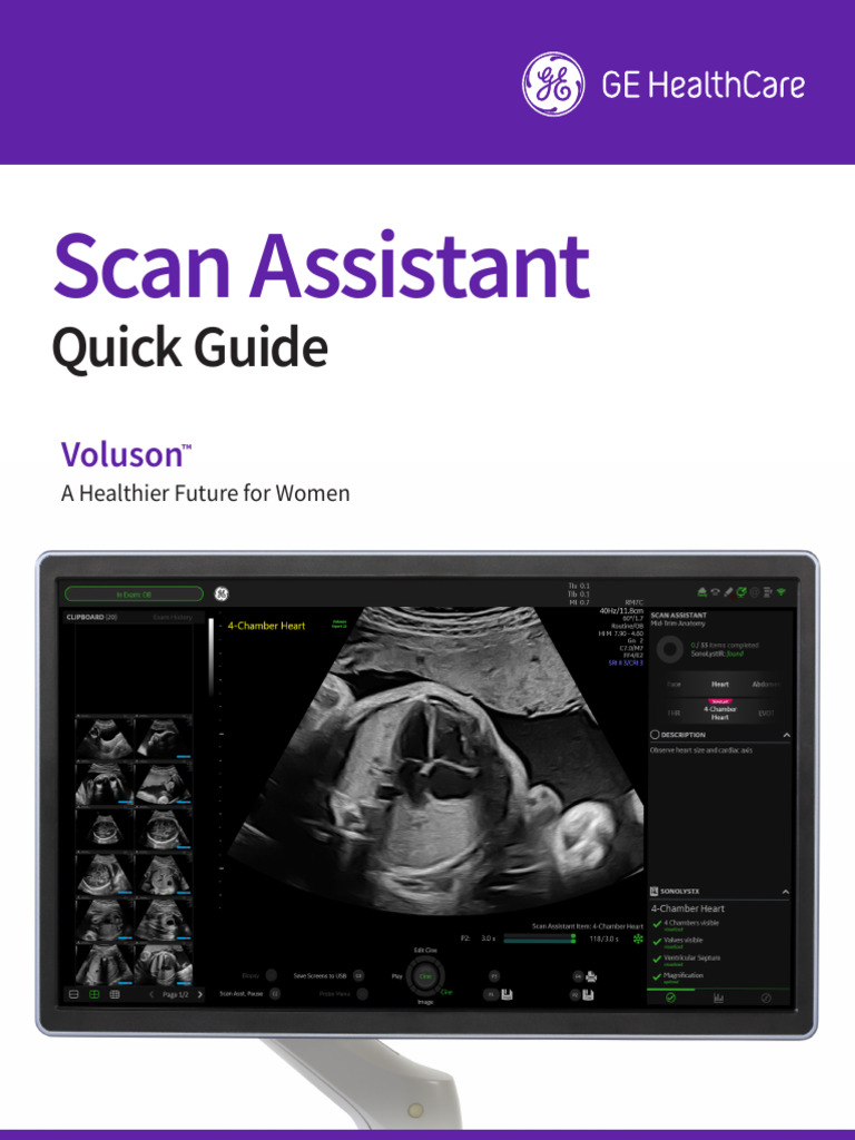 2024 Voluson Scan Assistant Quick Guide jb25556xx | PDF | Computer ...