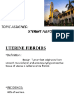 Uterine Fibroids