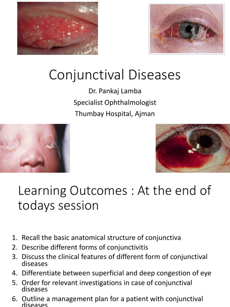 L2C Conjunctival Diseases - Compressed | PDF | Immunology | Microbiology