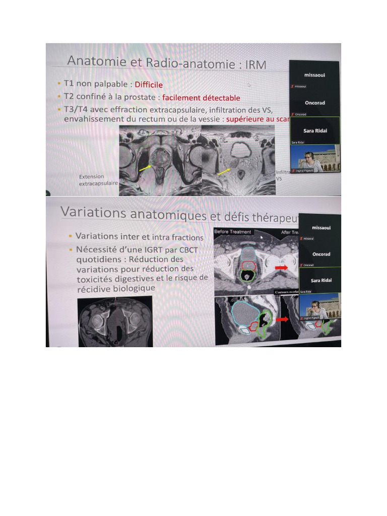 Prostate | PDF