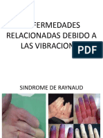 ENFERMEDADES RELACIONADAS DEBIDO A LAS VIBRACIONES