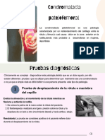 Condromalacia Patelofemoral