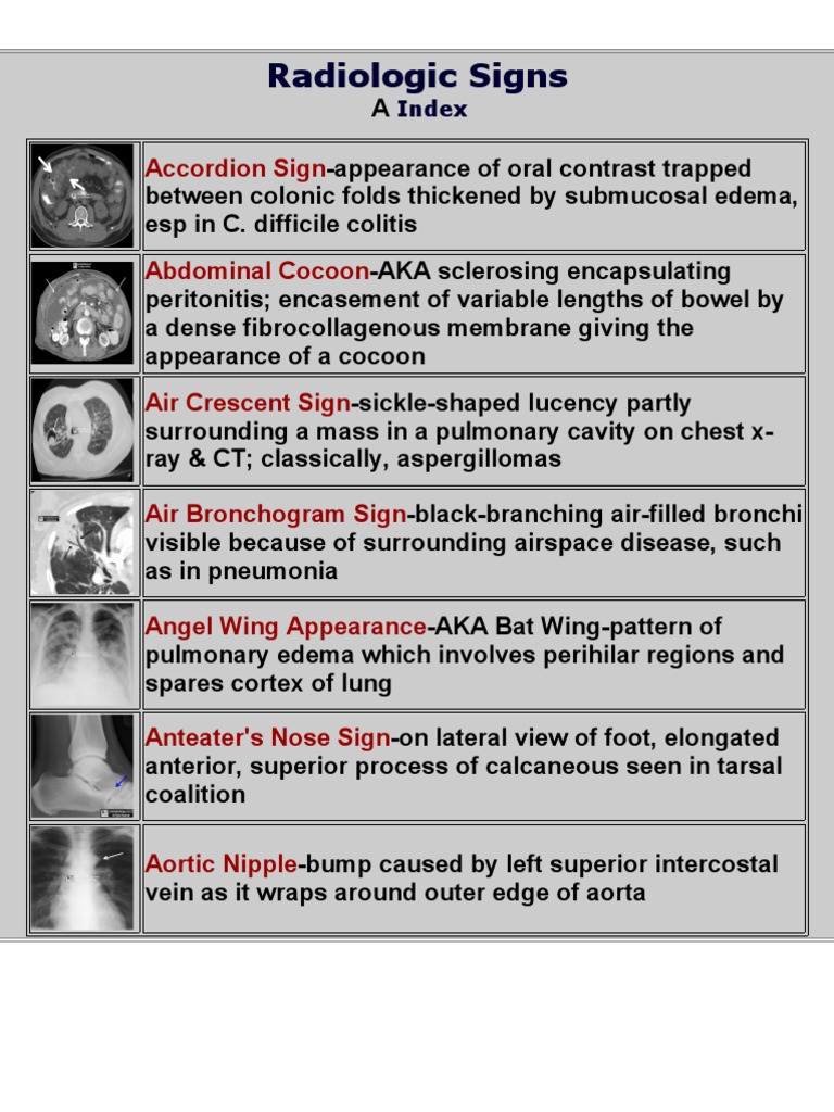 Key Radiologic Signs Overview | PDF | Lung | Vertebra