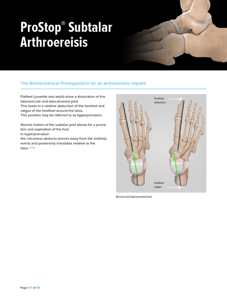 (ARTHREX) - ProStop - (Técnica) | PDF | Musculoskeletal System ...