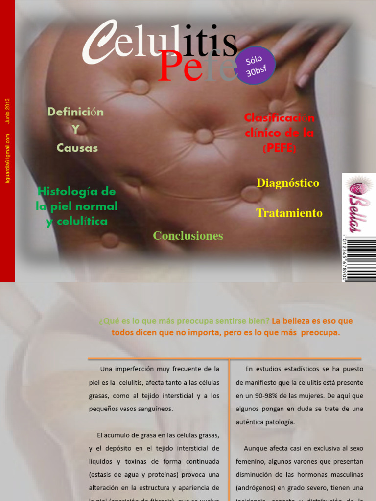 Dokumen - Tips Pefe Celulitis Lipodistrofia | PDF | Medicina CLINICA ...