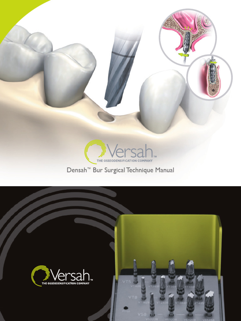 VRSA 0034 Densah Bur Kit Web Manual16 | Download Free PDF | Dental ...