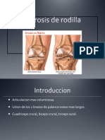 Artrosis de rodilla