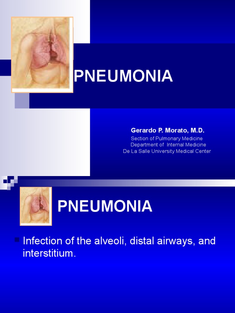 Med Ppt Pneumonia For Lecture Pneumonia Epidemiology