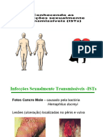 Doencas Sexualmente Transmissiveis