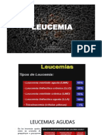 Leucemia