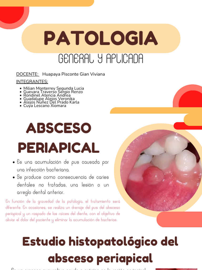 Abceso Periapical y Granuloma Periapical | PDF | Inflamación | Hueso