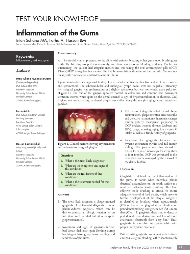 Test Your Knowledge | PDF | Periodontology | Human Tooth